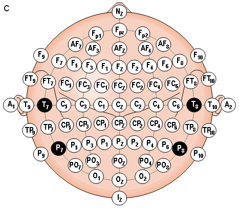Electrode placement.gif